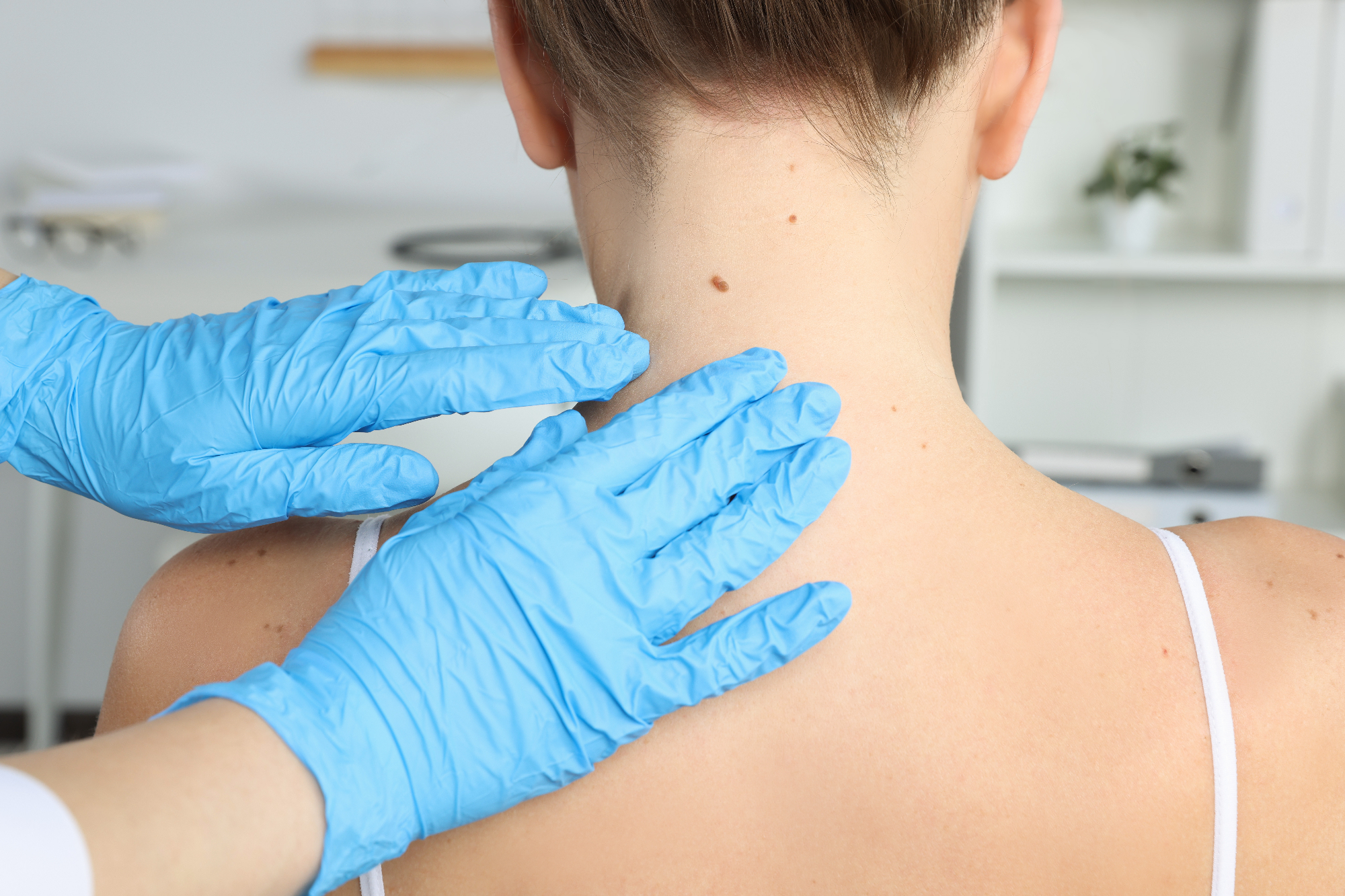 Dermatologija Ljubljana me je še kako rešila